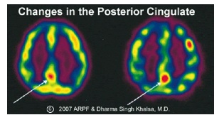 PET scan hersenen voor en na meditatie